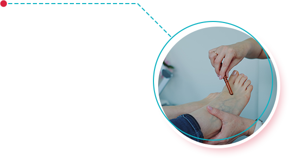 Diabetic Foot Care
